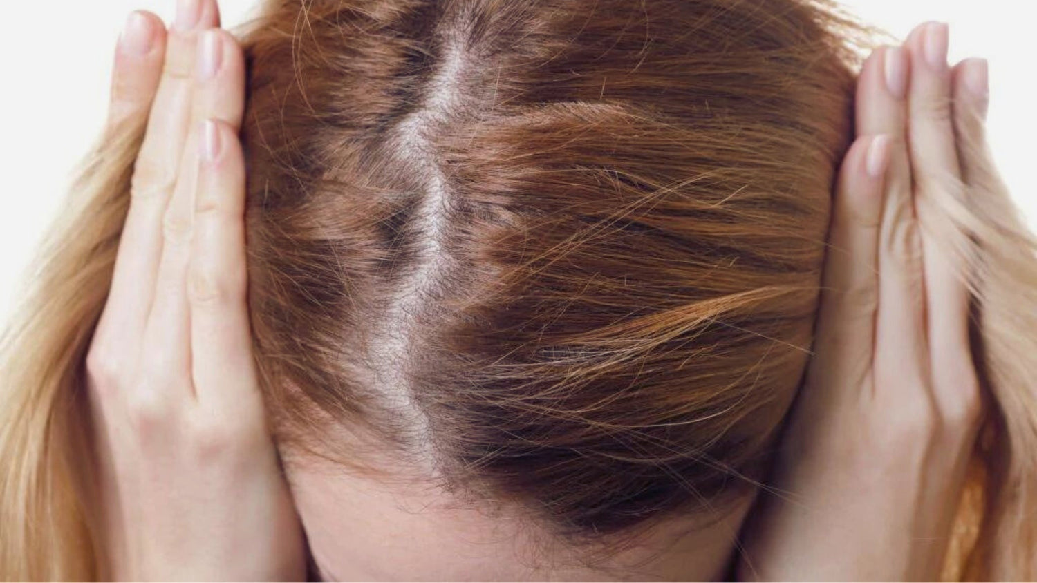 Luonnollinen hiushuuhde hoitaa päänahkaa ja edistää hiusten tervettä kasvua