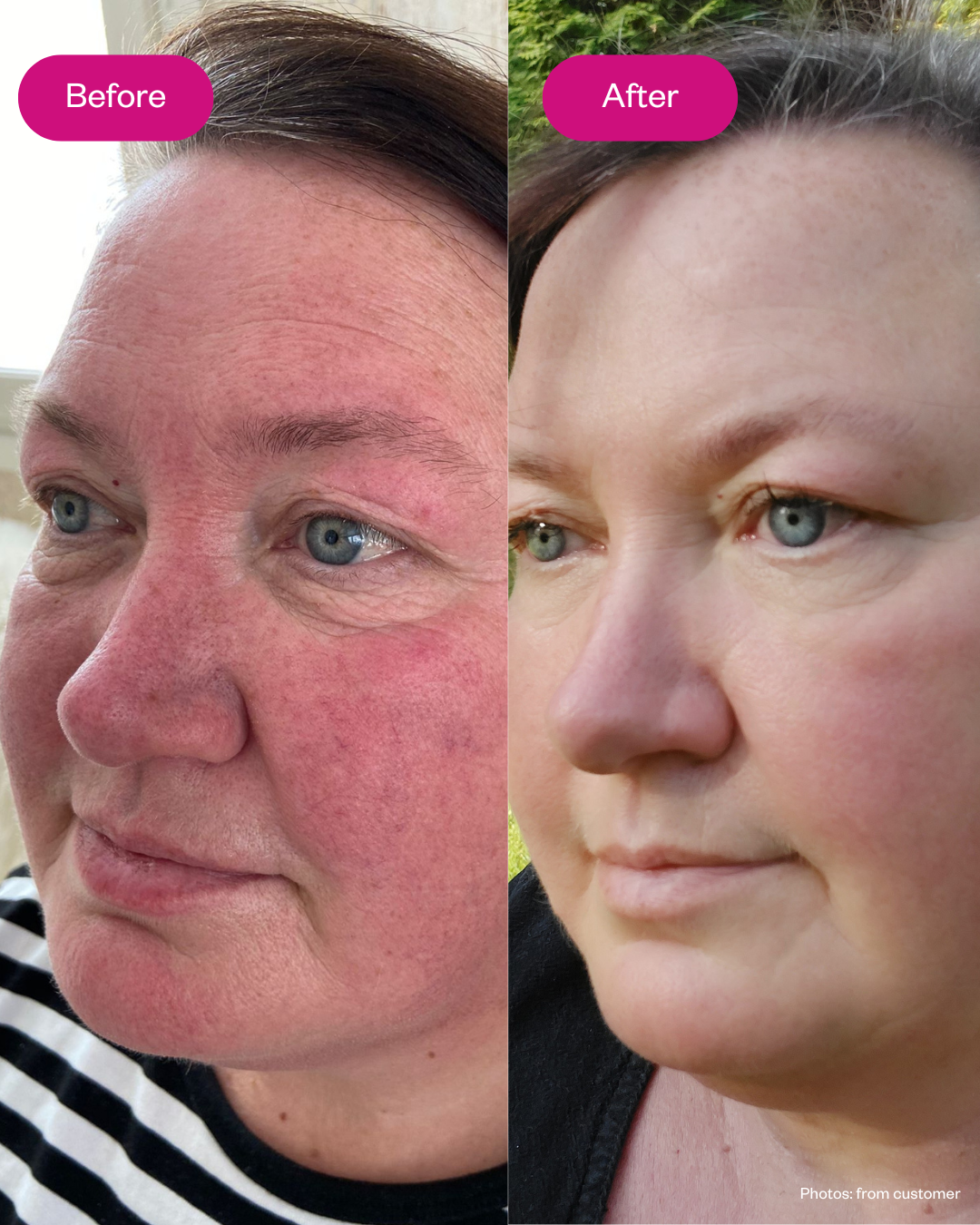 Retin 3-in-1 Cream for Aging Skin